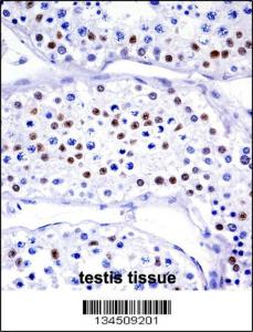 Anti-UBA1 Rabbit Polyclonal Antibody (FITC (Fluorescein Isothiocyanate))