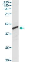 Anti-ADH1C Rabbit Polyclonal Antibody