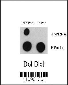 Anti-ATF2 Rabbit Polyclonal Antibody (HRP (Horseradish Peroxidase))