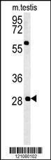 Anti-GSTO2 Rabbit Polyclonal Antibody (AP (Alkaline Phosphatase))