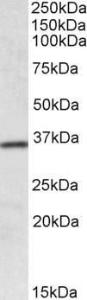 Anti-HOXA4 Antibody (A84817) (0.1 µg/ml) staining of Human Colon lysate (35 µg protein in RIPA buffer). Primary incubation was 1 hour. Detected by chemiluminescence