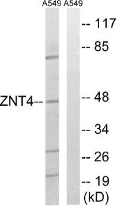 Western blot analysis of lysates from A549 cells using Anti-SLC30A4 Antibody. The right hand lane represents a negative control, where the antibody is blocked by the immunising peptide.