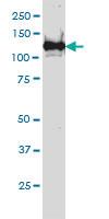 Anti-BUB1B Mouse Monoclonal Antibody [clone: 3F2]