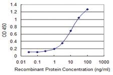 Anti-GNL3 Mouse Monoclonal Antibody [clone: 1A1]