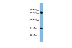 Anti-HIRIP3 Rabbit Polyclonal Antibody