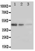 Anti-ErbB 3 Rabbit Polyclonal Antibody