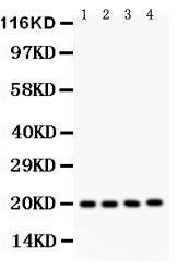 Anti-PARK7/DJ1 Polyclonal Antibody