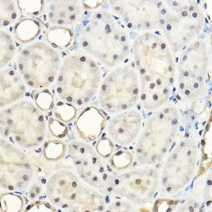 Immunohistochemistry analysis of paraffin-embedded rat kidney using Anti-AKT1 + AKT2 + AKT3 Antibody (A306139) at a dilution of 1:100 (40X lens). Perform high pressure antigen retrieval with 10 mM citrate buffer pH 6.0 before commencing with IHC staining protocol