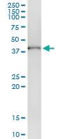 Anti-ADH1C Rabbit Polyclonal Antibody