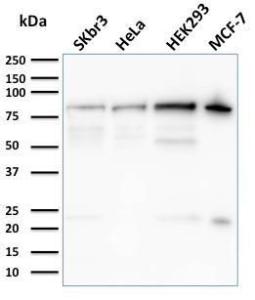 Western blot analysis of SK-BR-3, HeLa, HEK293, and MCF-7 cell lysates using Anti-Ezrin Antibody [CPTC-Ezrin-1]