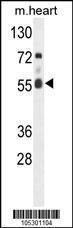 Anti-FASTK Rabbit polyclonal antibody