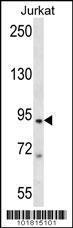 Anti-TAP1 Rabbit Polyclonal Antibody (AP (Alkaline Phosphatase))