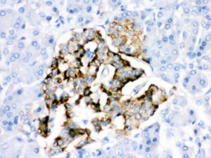 Anti-BAG2 Rabbit Polyclonal Antibody