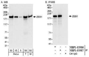 Anti-DUT Rabbit Polyclonal Antibody