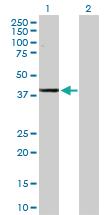 Anti-ADH1C Rabbit Polyclonal Antibody