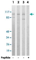 Anti-ACTN2 Rabbit Polyclonal Antibody