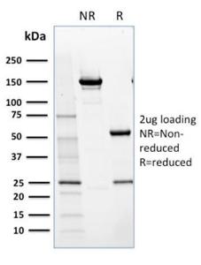 SDS-PAGE analysis of Anti-NRF1 Antibody [NRF1/2609] under non-reduced and reduced conditions; showing intact IgG and intact heavy and light chains, respectively. SDS-PAGE analysis confirms the integrity and purity of the antibody