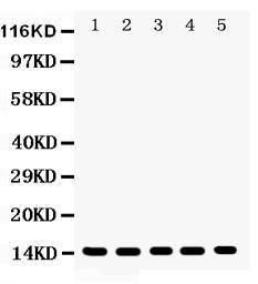 Anti-Profilin 1 Polyclonal Antibody