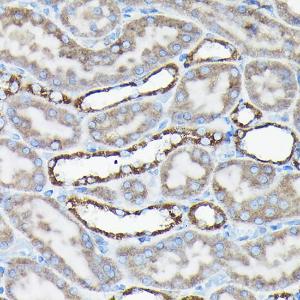 Immunohistochemistry analysis of paraffin-embedded rat kidney using Anti-AIF Antibody (A8473) at a dilution of 1:50 (40X lens). Perform high pressure antigen retrieval with 10 mM citrate buffer pH 6.0 before commencing with IHC staining protocol