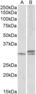 Anti-HOXA9 Antibody (A84819) (1µg/ml) staining of Mouse and Rat Spinal Cord lysates (35µg protein in RIPA buffer). Primary incubation was 1 hour. Detected by chemiluminescence.