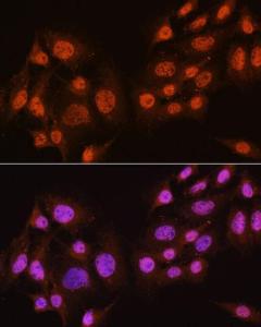 Immunofluorescence analysis of C6 cells using Anti-AKT1 + AKT2 + AKT3 Antibody (A306139) at a dilution of 1:100. DAPI was used to stain the cell nuclei (blue)