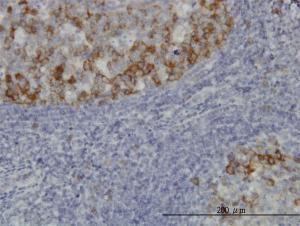 Anti-BUB1B Mouse Monoclonal Antibody [clone: 3F2]