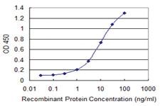 Anti-GNL3 Mouse Monoclonal Antibody [clone: 3A3]