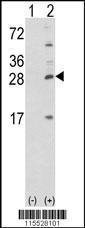 Anti-PRL Rabbit Polyclonal Antibody (Biotin)