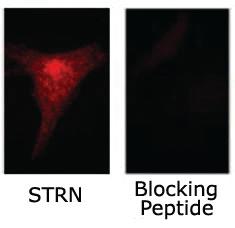 Anti-STRN Rabbit Polyclonal Antibody