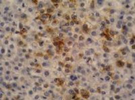 Anti-AFP Mouse Monoclonal Antibody [clone: AFP-11]