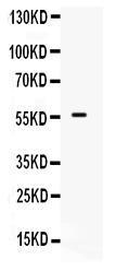 Anti-BMPR1B Rabbit Polyclonal Antibody