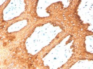 Immunohistochemical analysis of formalin-fixed, paraffin-embedded human skin using Anti-Keratin 76 Antibody [KRTH/4392R]