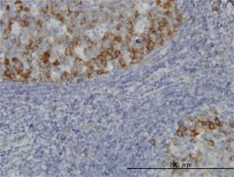 Anti-BUB1B Mouse Monoclonal Antibody [clone: 3F2]