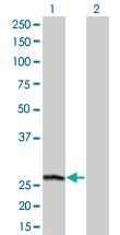 Anti-PSPH Mouse Monoclonal Antibody [clone: 3A5]