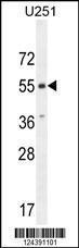 Anti-ACKR3 Rabbit Polyclonal Antibody (HRP (Horseradish Peroxidase))