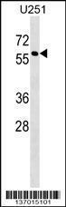 Anti-MPI Rabbit Polyclonal Antibody (HRP (Horseradish Peroxidase))