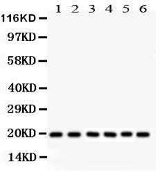 Anti-Pin1 Polyclonal Antibody