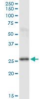 Anti-PSPH Mouse Monoclonal Antibody [clone: 3A5]