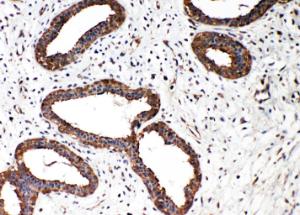 Anti-Smad2 Rabbit Polyclonal Antibody