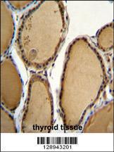 Anti-PPP1R21 Rabbit Polyclonal Antibody (HRP (Horseradish Peroxidase))