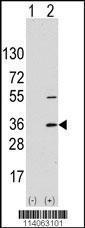 Anti-Translocon-associated Protein Subunit alpha Rabbit Polyclonal Antibody