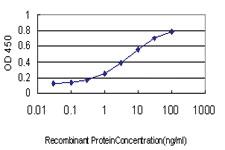 Anti-BUB1B Mouse Monoclonal Antibody [clone: 3F2]