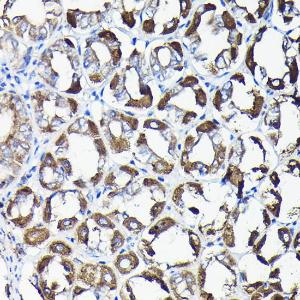 Immunohistochemistry analysis of paraffin-embedded mouse stomach using Anti-AIF Antibody (A8473) at a dilution of 1:50 (40X lens). Perform high pressure antigen retrieval with 10 mM citrate buffer pH 6.0 before commencing with IHC staining protocol