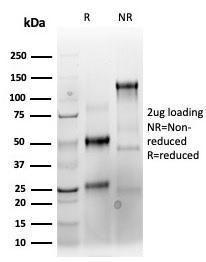 SDS-PAGE analysis of Anti-Keratin 76 Antibody [KRTH/4392R] under non-reduced and reduced conditions; showing intact IgG and intact heavy and light chains, respectively. SDS-PAGE analysis confirms the integrity and purity of the antibody