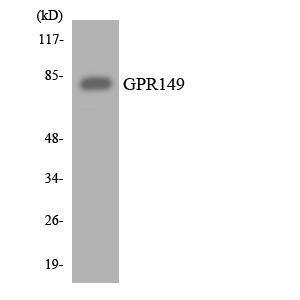 Western blot analysis of the lysates from 293 cells using Anti-GPR149 Antibody