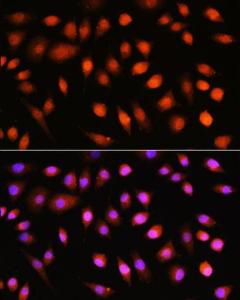 Immunofluorescence analysis of L929 cells using Anti-AKT1 + AKT2 + AKT3 Antibody (A306139) at a dilution of 1:100. DAPI was used to stain the cell nuclei (blue)