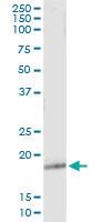 Anti-GPX5 Antibody Pair