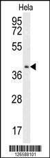 Anti-CMPK2 Rabbit Polyclonal Antibody (APC (Allophycocyanin))