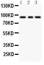 Anti-PKC Epsilon Polyclonal Antibody