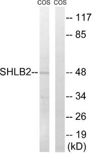 Western blot analysis of lysates from COS7 cells using Anti-SH3GLB2 Antibody. The right hand lane represents a negative control, where the antibody is blocked by the immunising peptide